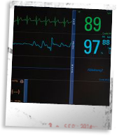 Cardiovascular or Cerebrovascular Events